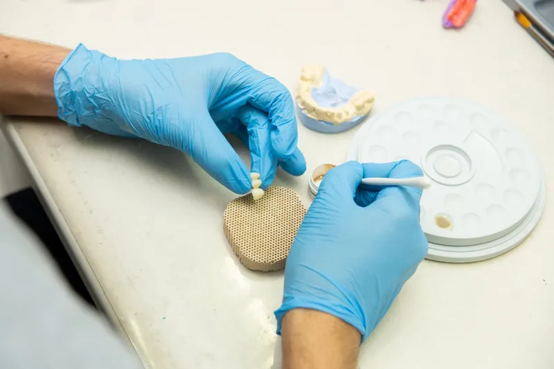 Dental crown fabrication process in a dental laboratory — precision manufacturing of zirconia and ceramic crowns at Turkish dental clinics with international quality standards
