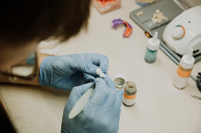 Dental lab technician hand-crafting a prosthetic restoration — skilled craftsmanship underpinning the quality of crowns, bridges and veneers at top international dental clinics